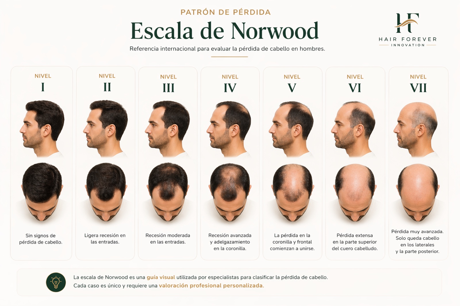 Escala de Norwood ampliada